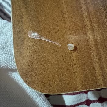 Ruffles Cipsin İçinden Yabancı Maddeler Çıktı, Sağlığım Tehlikeye Girdi