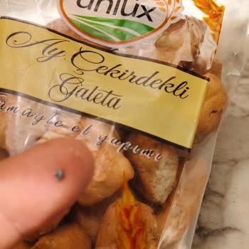 Galeta İçinden Yabancı Madde Çıkması ve Diş Kırılması Şikayeti