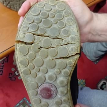 Camper Ayakkabının Tabanı Kısa Sürede İkiye Bölündü, Destek Alamadım