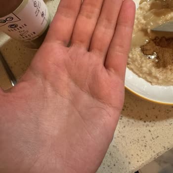 Bebek Ürününde Kıl Ve Böcek Şoku: Og Natural'den Kötü Deneyim