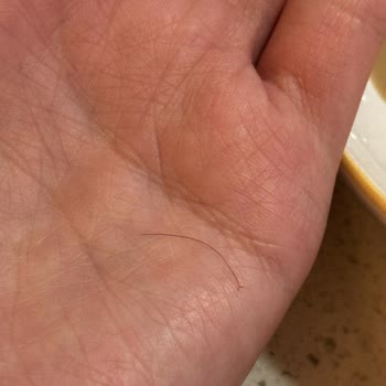 Bebek Ürününde Kıl Ve Böcek Şoku: Og Natural'den Kötü Deneyim