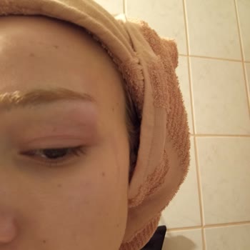 Saç Maskesi Ambalaj Sorunu ve Olası Alerjik Reaksiyon
