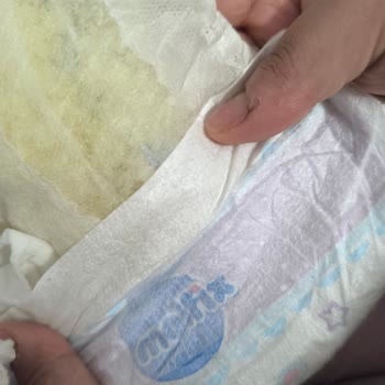 Molfix Bebek Bezlerinde Eski Kalite Yok Tuhaf Yapışkanlarla Karşılaştım