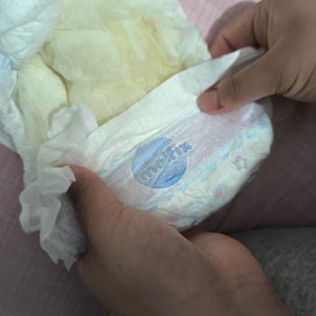 Molfix Bebek Bezlerinde Eski Kalite Yok Tuhaf Yapışkanlarla Karşılaştım