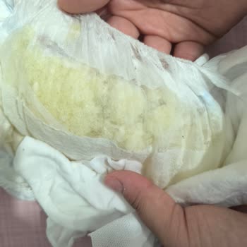 Molfix Bebek Bezlerinde Eski Kalite Yok Tuhaf Yapışkanlarla Karşılaştım