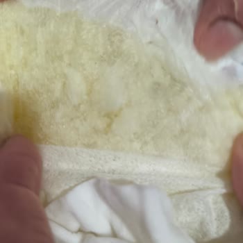 Molfix Bebek Bezlerinde Eski Kalite Yok Tuhaf Yapışkanlarla Karşılaştım