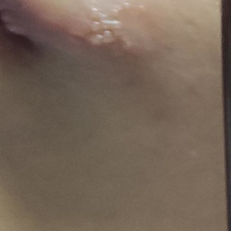 Kozmetik Ürün Nedeniyle Sağlık Sorunu Ve İade Talebimin Reddedilmesi