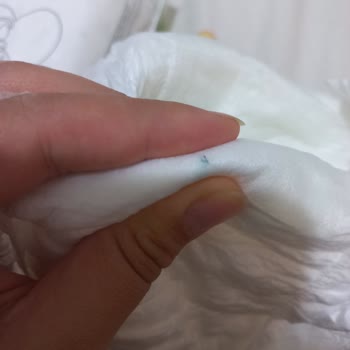 Sleepy Bebek Bezinde Mavi Sert Cisim Şoku
