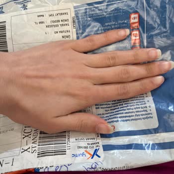 Sipariş Edilen Ürün Farklı Geldi, İade Ve İletişim Sorunu Yaşadım