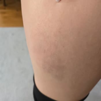 Aldığım EMS Cihazı Hem Arızalı Hem De Sağlık Sorunlarına Yol Açtı