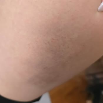 Aldığım EMS Cihazı Hem Arızalı Hem De Sağlık Sorunlarına Yol Açtı