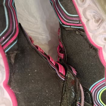 Yeni Alınan Skechers Ayakkabının İki Haftada Parçalanması Ve Red Cevabı Mağduriyeti