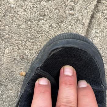 Kısa Sürede Açılan Ve Koku Yapan Ayakkabı Hayal Kırıklığı