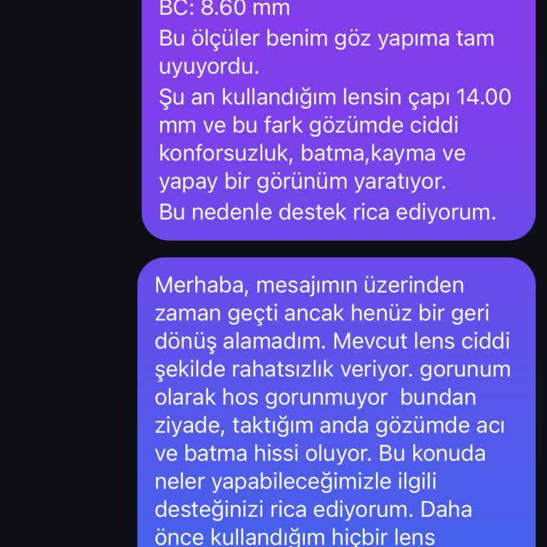 Kullandığım Lens Gözümde Sorun Yarattı, İade Talep Ediyorum