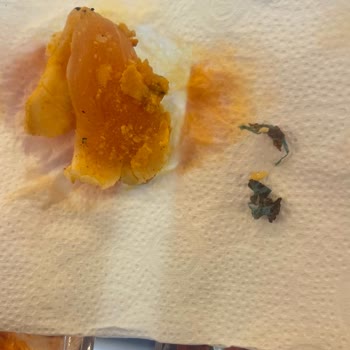 Lezita Tavuk Dönerde Pişmemiş Et Ve Plastik Parçası Şoku