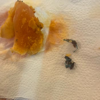 Lezita Tavuk Dönerde Pişmemiş Et Ve Plastik Parçası Şoku