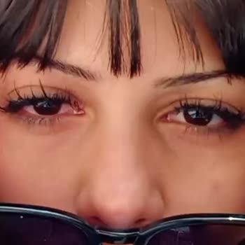 Hijyenik Olmayan Güzellik Hizmeti Sonrası Göz Sağlığı Sorunu