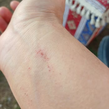 Uşak Öğretmenevi'nde Hijyen Ve Konfor Sorunları Nedeniyle Yaşadığım Olumsuz Deneyim