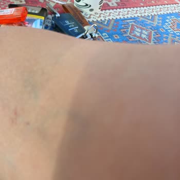 Uşak Öğretmenevi'nde Hijyen Ve Konfor Sorunları Nedeniyle Yaşadığım Olumsuz Deneyim