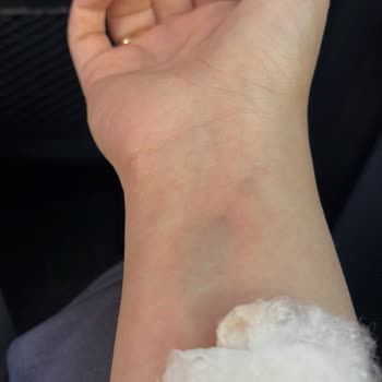 Acil Serviste Hemşire Davranışı Ve Uygulama Hataları Nedeniyle Yaşadığım Olumsuz Deneyim