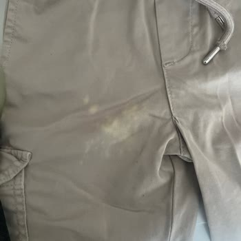 Leke Çıkarıcı Kıyafetlerimin Rengini Açtı!