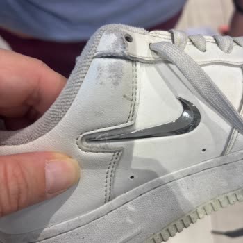 Ayakkabımın Derisi Döküldü, Garanti Süresi Bahane Edildi!