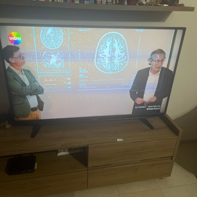 Yeni Alınan Arçelik Televizyonda Tekrarlayan Ekran Kartı Sorunu