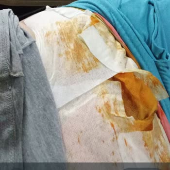 Philips Kazanlı Ütü Patladı, Kardeşim Yaralandı!