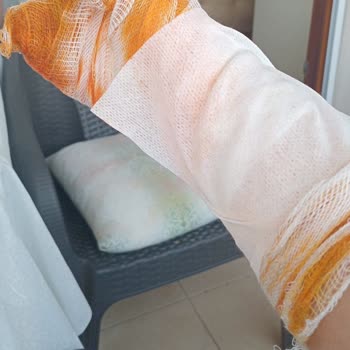 Philips Kazanlı Ütü Patladı, Kardeşim Yaralandı!