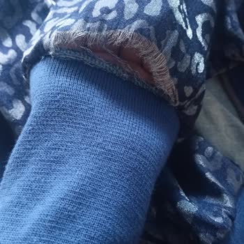 Aldığım Üründe Dikiş Problemi Ve Yetersiz Müşteri Hizmeti