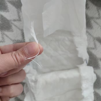 Bebek Bezi İçinden Çıkan Yabancı Madde Bebeğimin Sağlığını Tehdit Etti