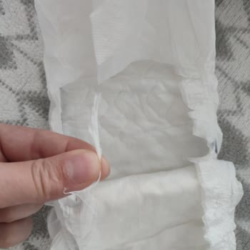 Bebek Bezi İçinden Çıkan Yabancı Madde Bebeğimin Sağlığını Tehdit Etti