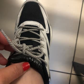 Skechers Ayakkabıda Deri Çatlaması Ve Olumsuz İnceleme Sonucu