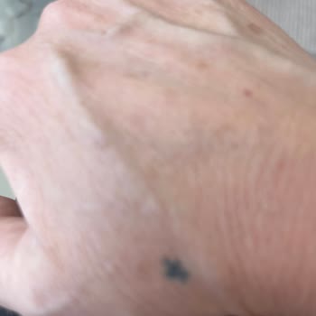 Nivea Leke Karşıtı Ürünler Cildimde Leke Artışına Sebep Oldu