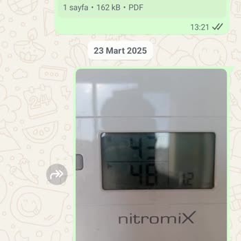 DemirDöküm Kombi Servisi Ve Ücret İadesi Sorunu