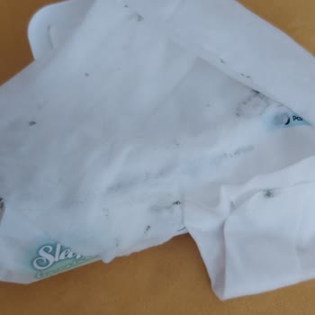Küflü Ve Kötü Kokulu Islak Mendil Şoku: Sağlığımız Tehlikede!