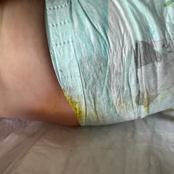 Prima Bebek Bezlerinde Islaklık Göstergesi Ve Sızdırma Sorunu Hayal Kırıklığı Yarattı