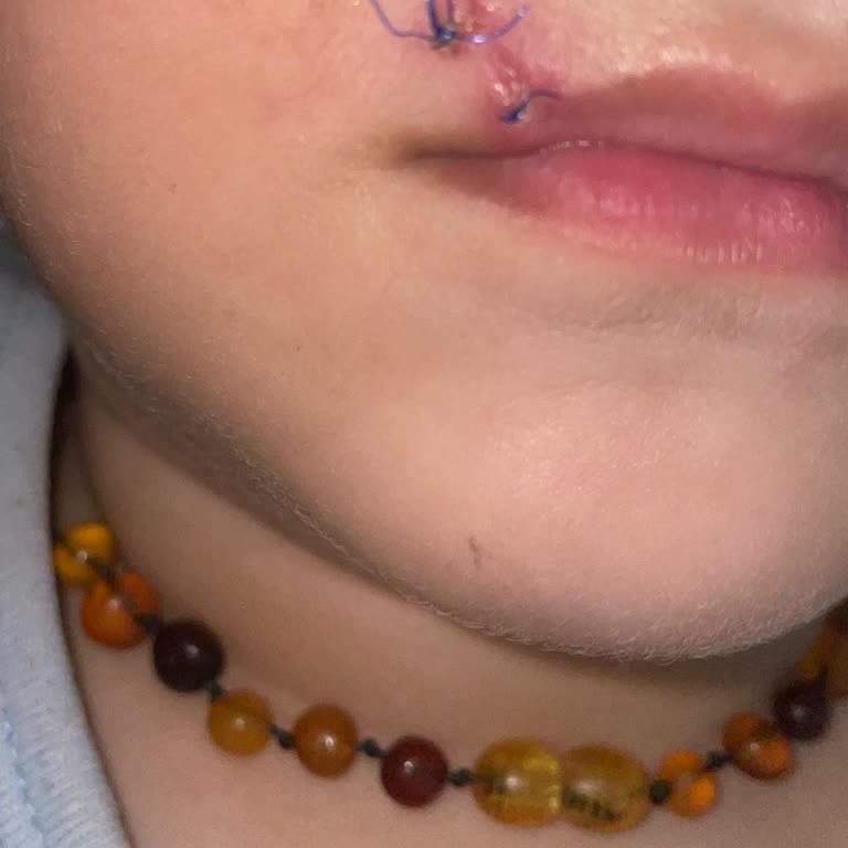 Acilde Oğlumun Yarasına İlgisiz Ve Kötü Müdahale