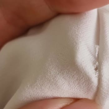 Alvina'dan Aldığım Ürün Hem Lekeli Hem Yırtık Çıktı, İlgisiz Davranıldı