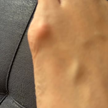 Lacoste Ayakkabıdaki Hata Nedeniyle İade Sorunu Ve Mağduriyet
