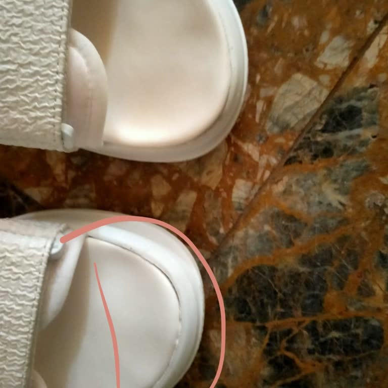 Bir Kez Giyilen Sandaletin Tabanı Çöktü, Mağaza Sorumluluk Almadı