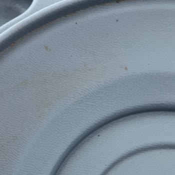 Birinci Göz Hastanesinde Hijyen Ve Fiyat Konusunda Büyük Hayal Kırıklığı