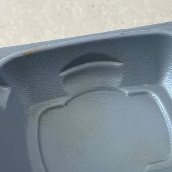 Birinci Göz Hastanesinde Hijyen Ve Fiyat Konusunda Büyük Hayal Kırıklığı