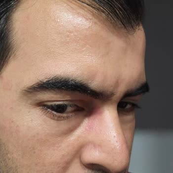 Sağlık Sorunu Yaratan Gözlük İçin İade Talebim Reddedildi, Çözüm Bekliyorum