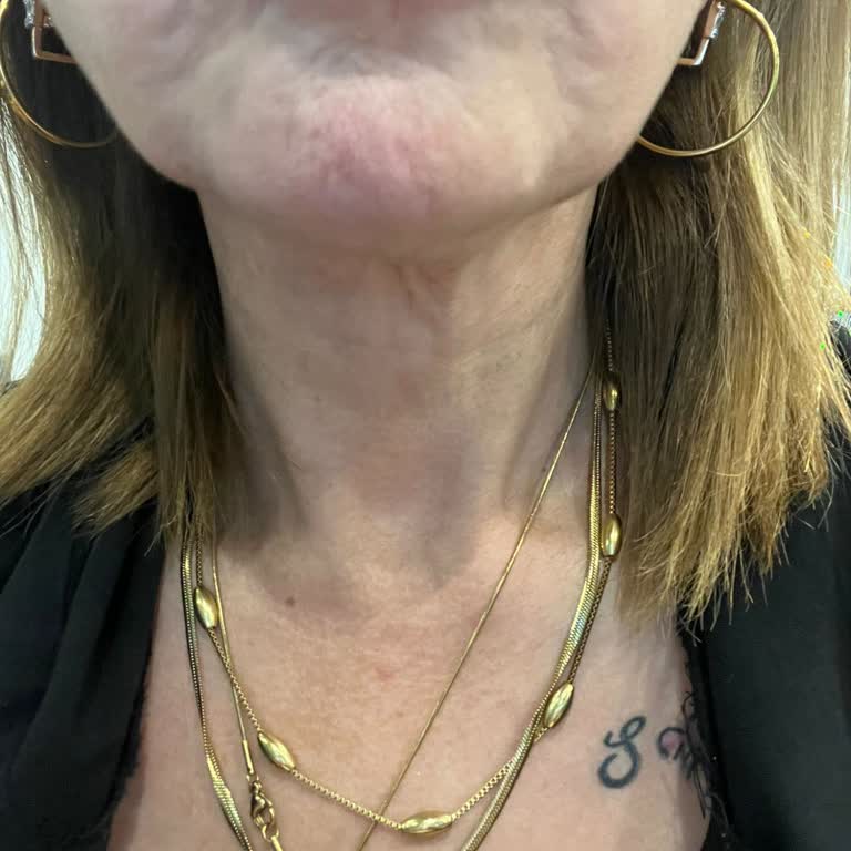 Calvin Clinic Bakırköy Pişmanlığı