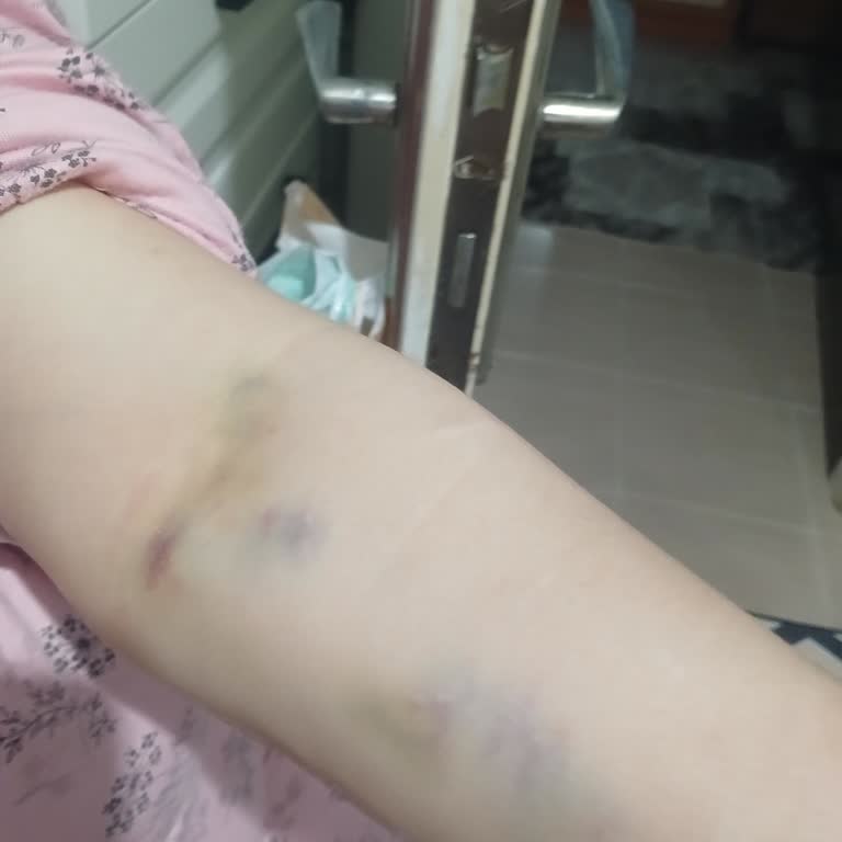 Yoğun Bakımda Asistan Ve Hemşirelerin Olumsuz Davranışları