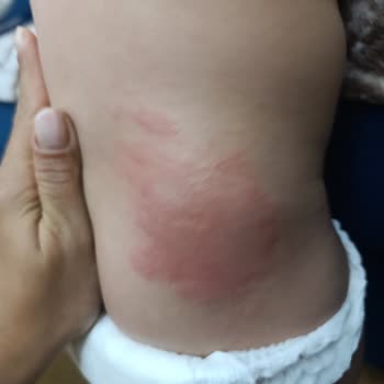 Molfix Bebek Bezi Cilt Sorunları Ve Kimyasal Koku Şikayeti