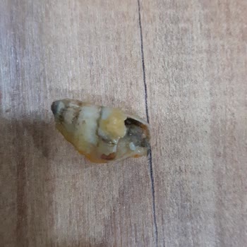 Soslu Fıstık Paketinden Salyangoz Çıkmasıyla Yaşadığım Şok