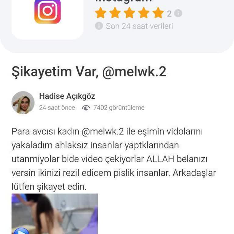 Hadise Açıkgöz'ün Davranışları Arkadaşımı Zor Durumda Bıraktı