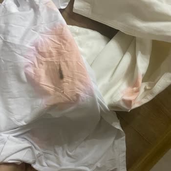Pamukkale Turizm’de Valizlerim Islandı Ve Kıyafetlerim Kullanılamaz Hale Geldi!